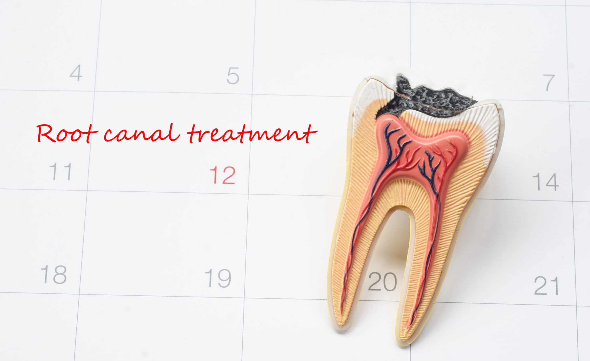 Need a Root Canal in Park City UT?